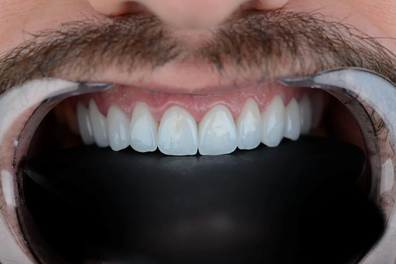 Dental treatment photo 1