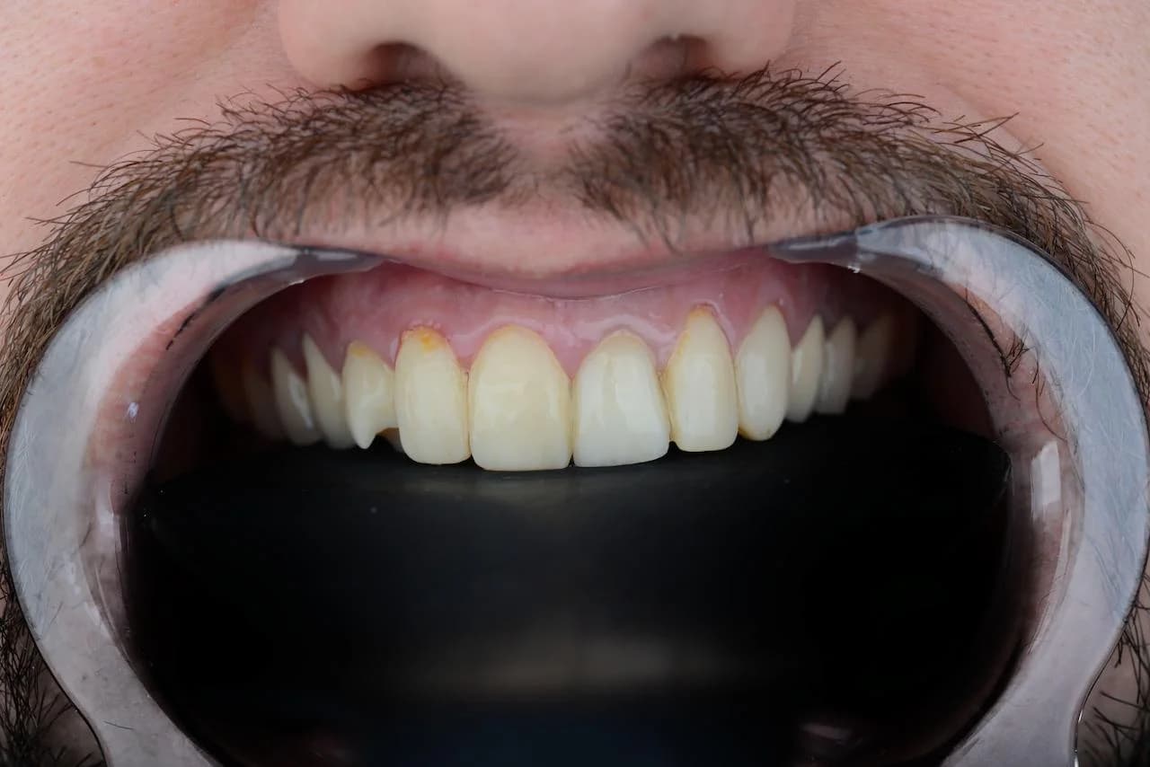 Dental treatment photo 2