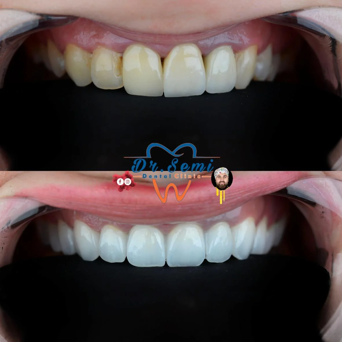 Dental treatment photo 3