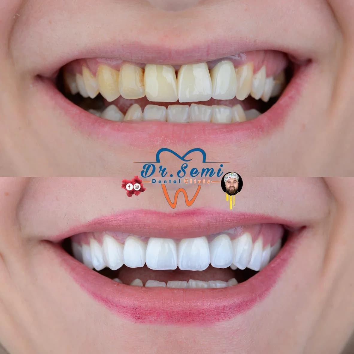Dental treatment photo 4