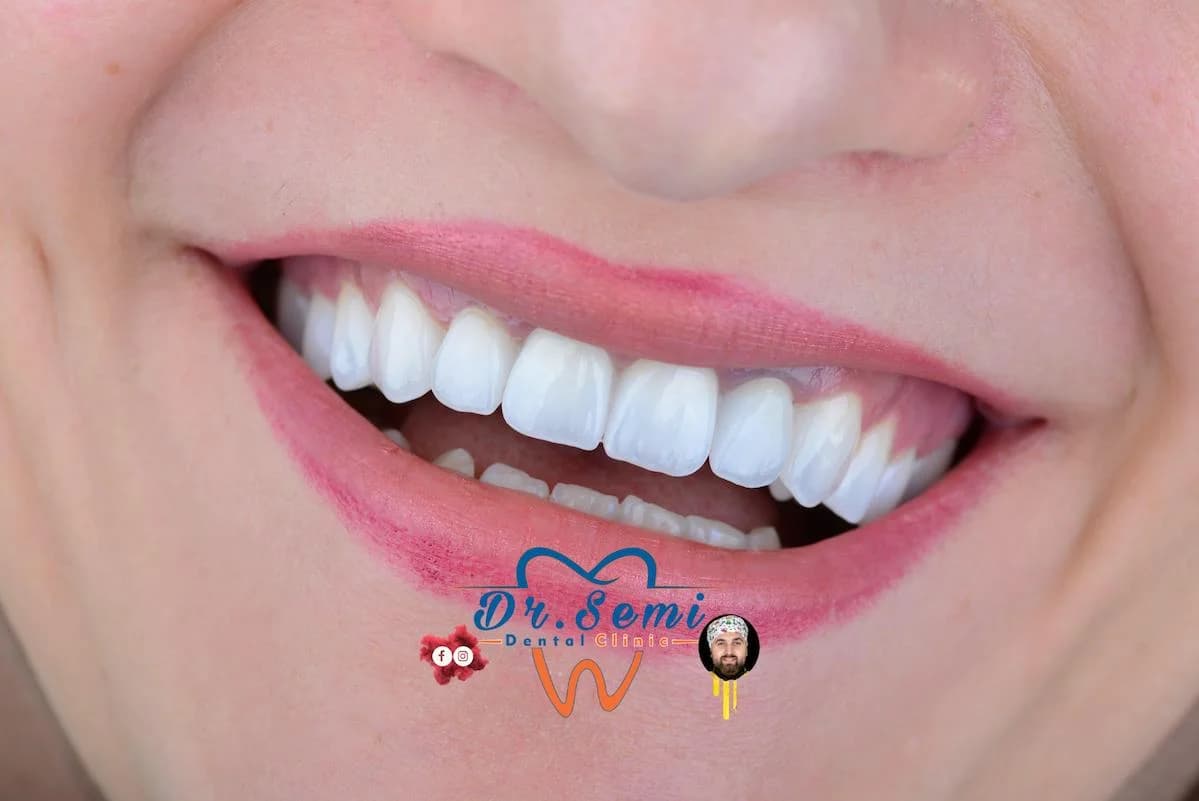 Dental treatment photo 5