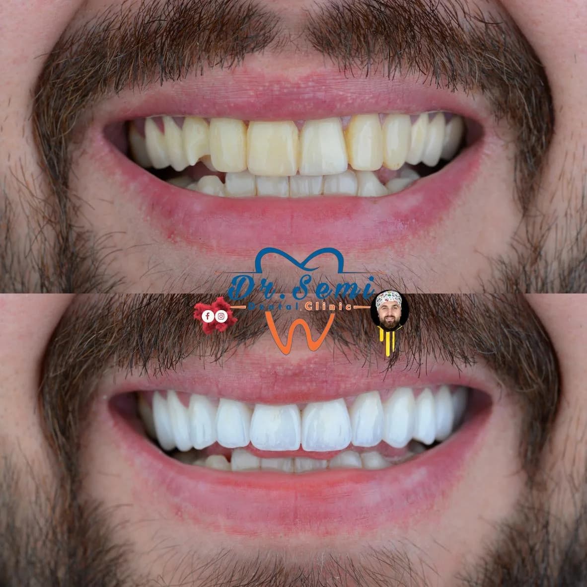 Dental treatment photo 6