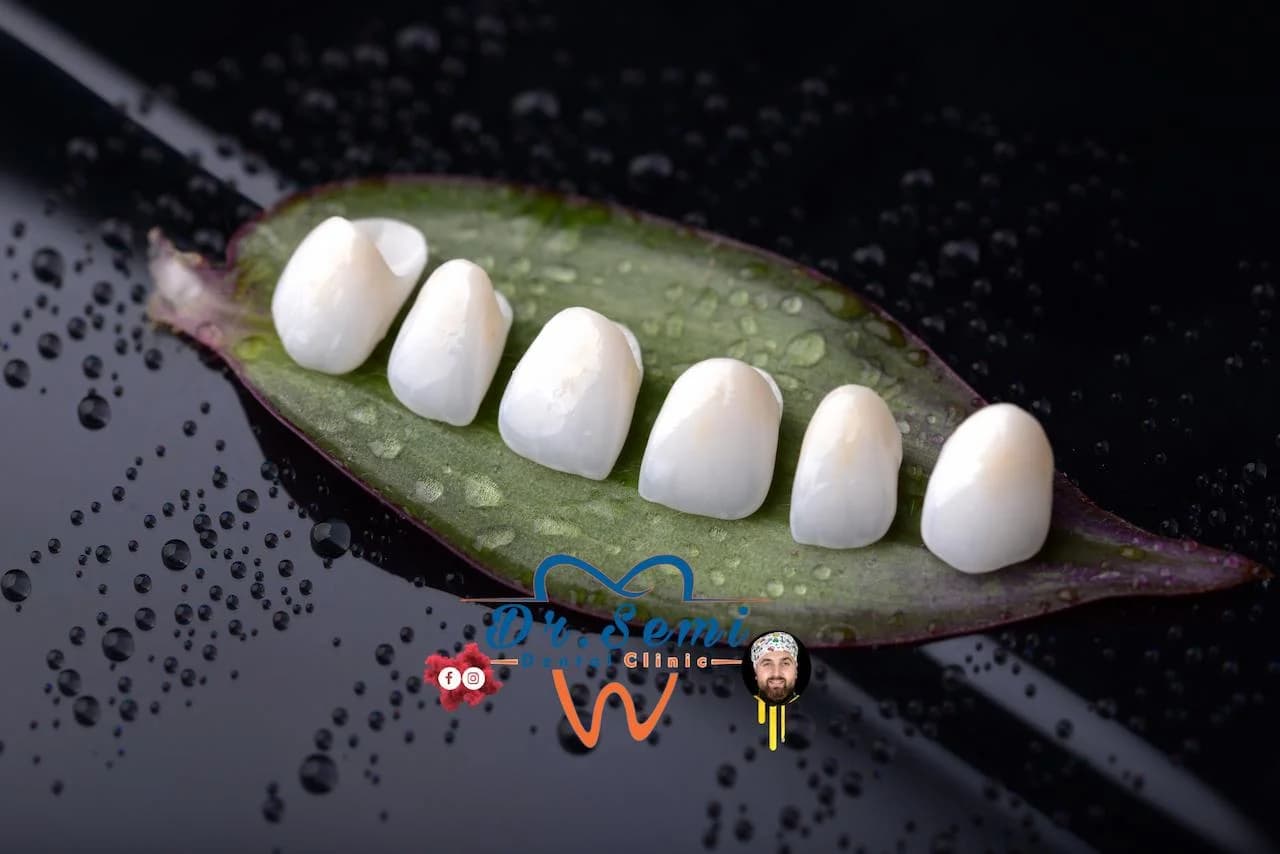 Dental treatment photo 7