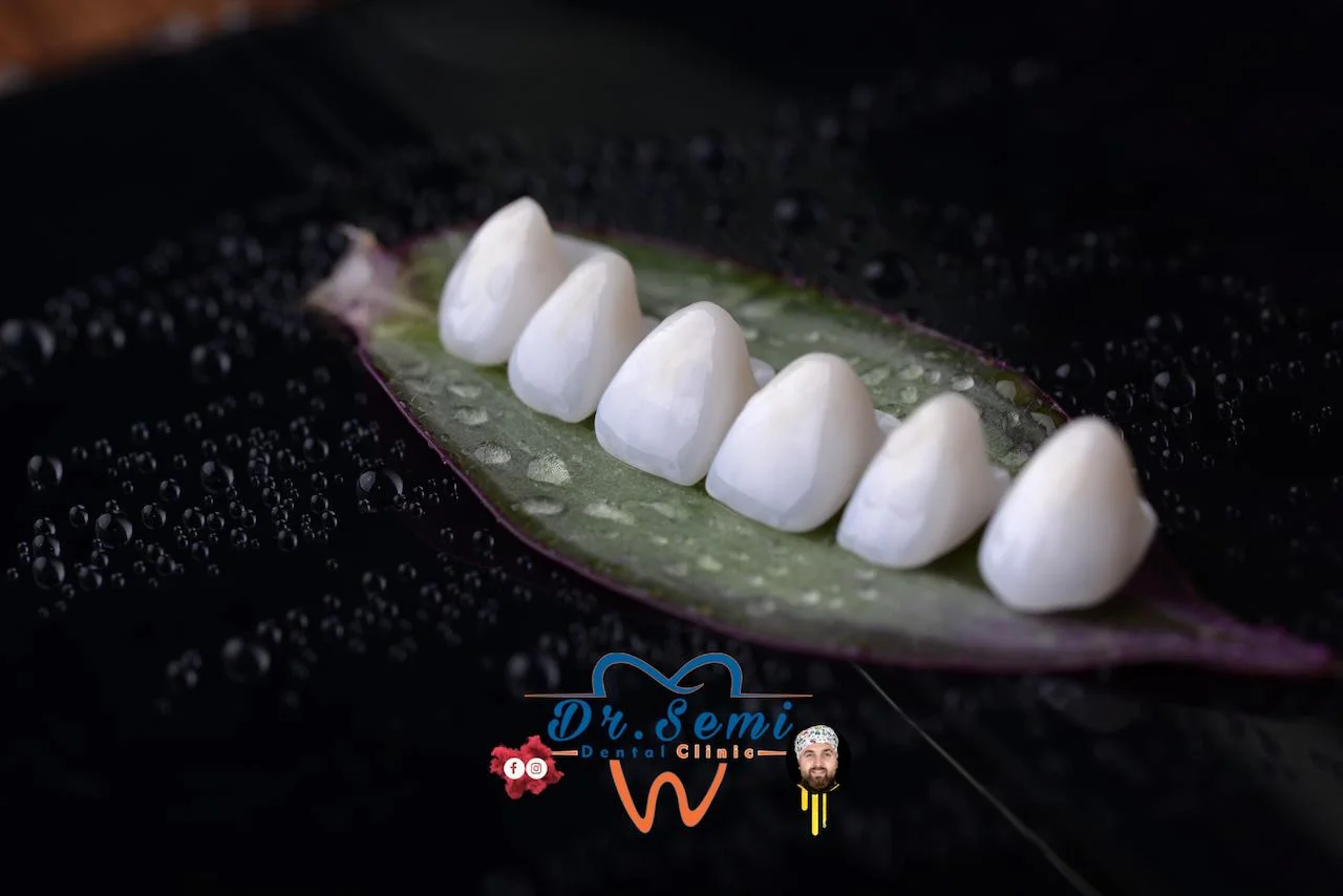 Dental treatment photo 8
