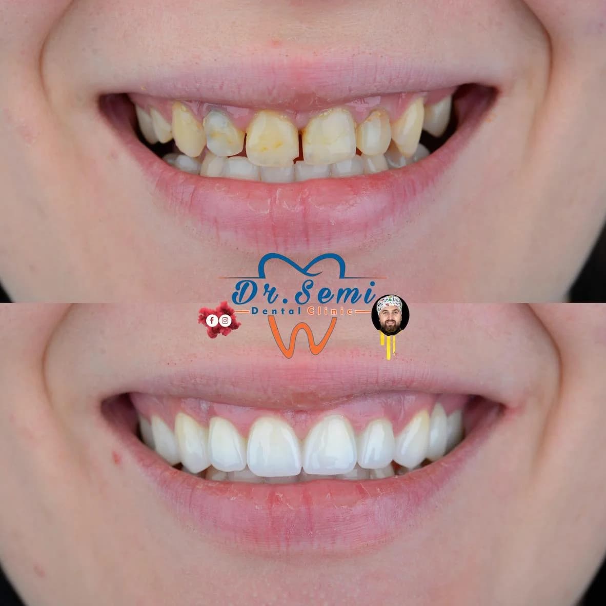 Dental treatment photo 9