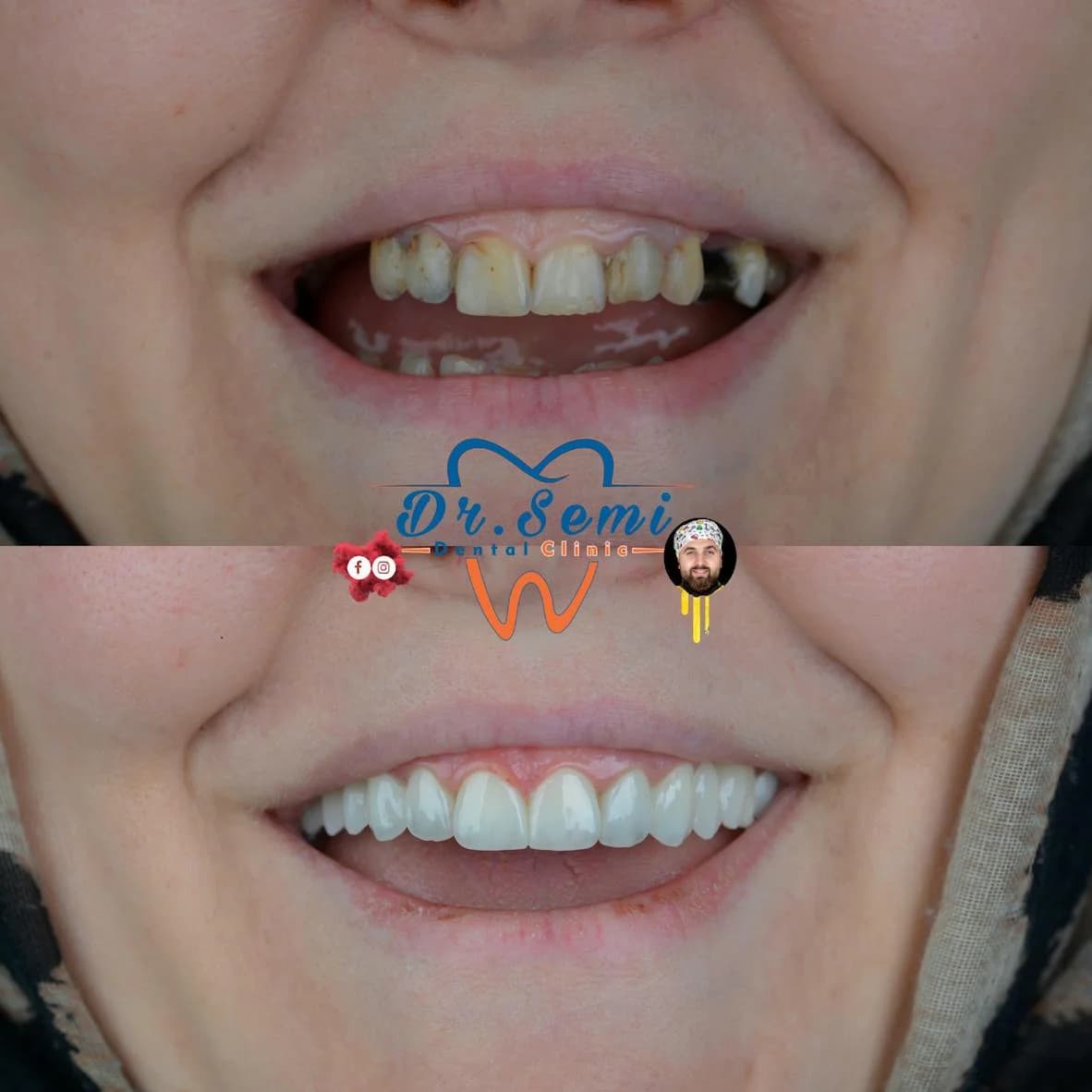 Dental treatment photo 10