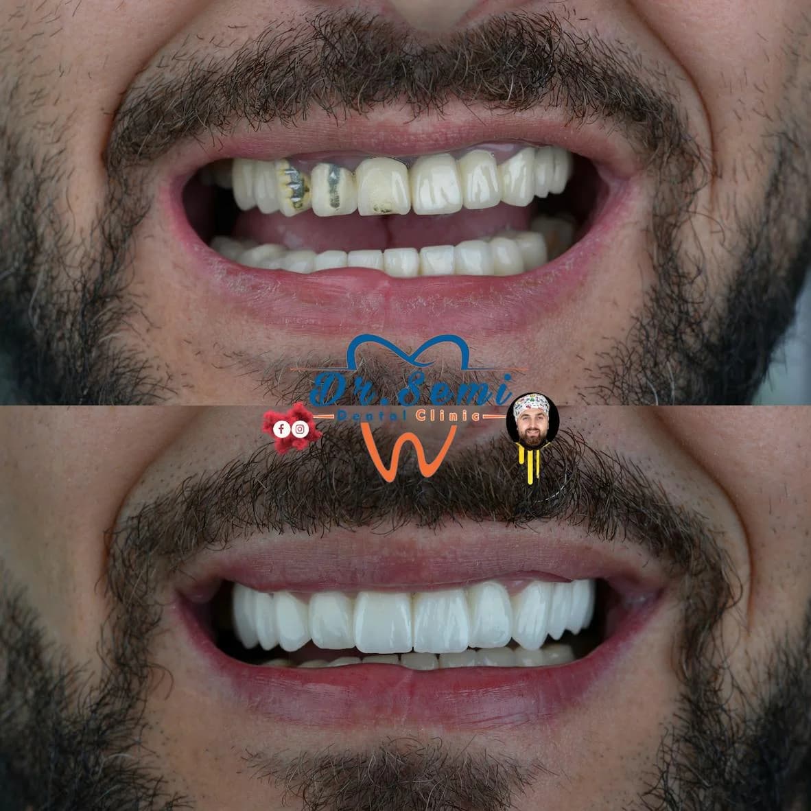 Dental treatment photo 11