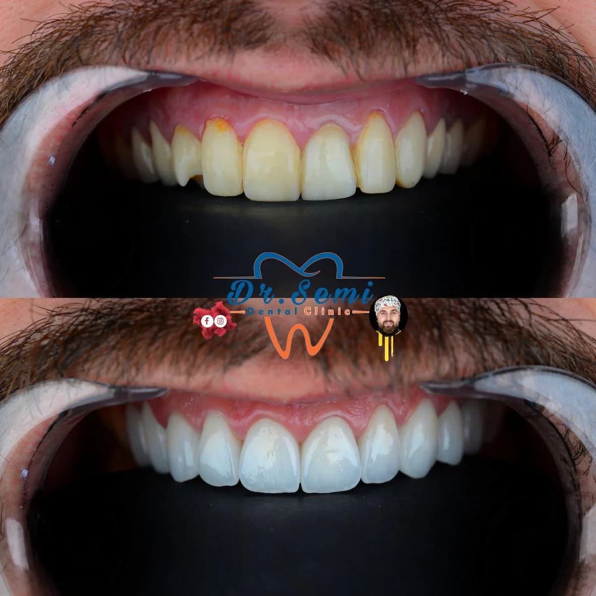 Dental treatment photo 12