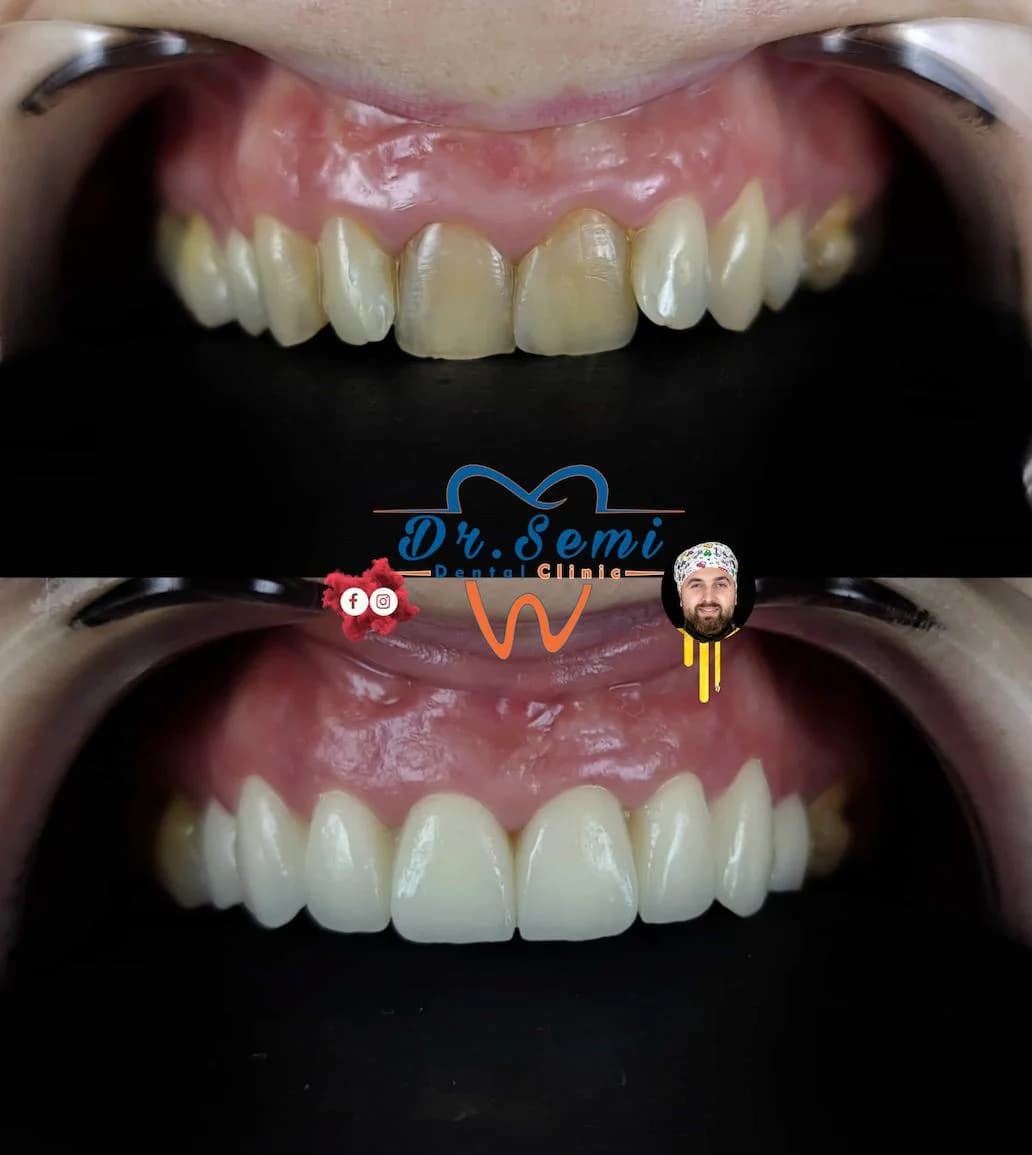 Dental treatment photo 13