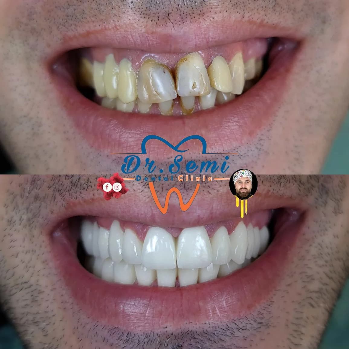 Dental treatment photo 14
