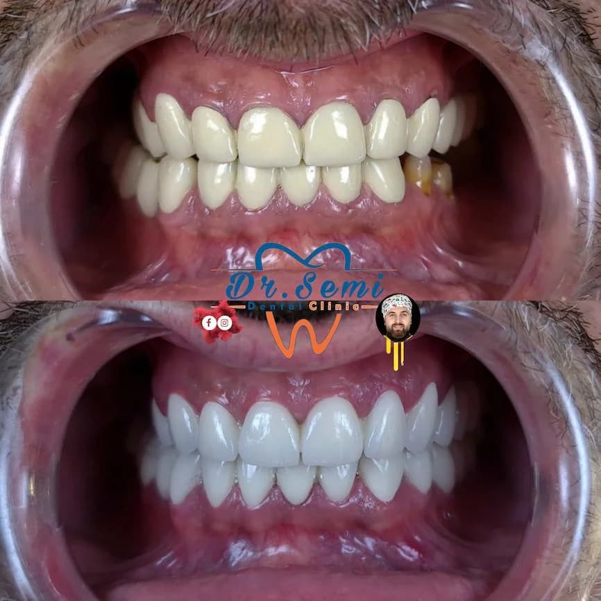 Dental treatment photo 15
