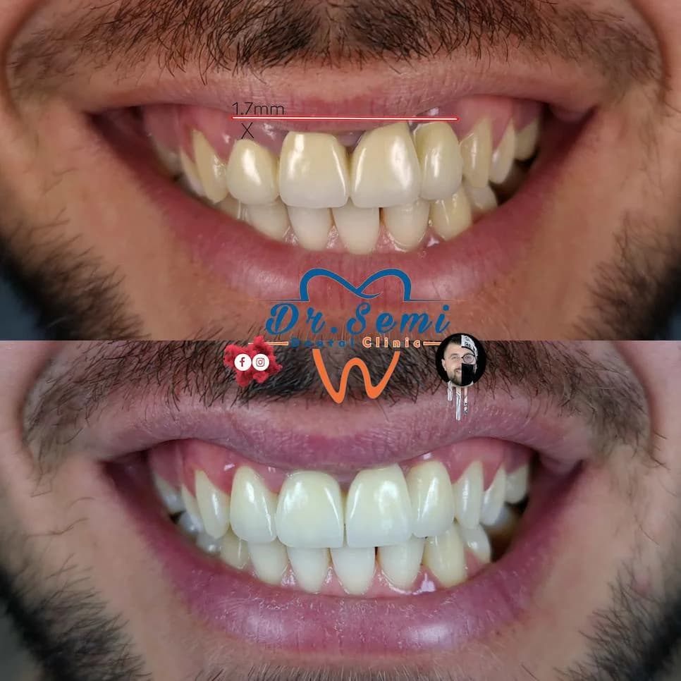 Dental treatment photo 16