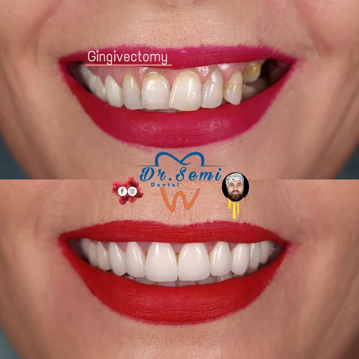 Dental treatment photo 17