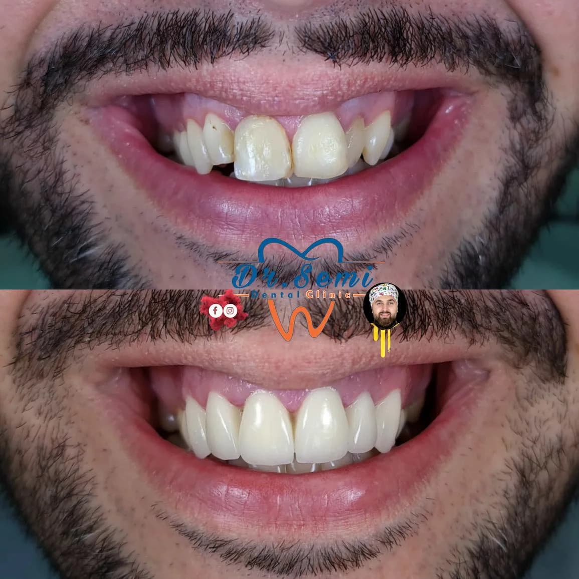 Dental treatment photo 19