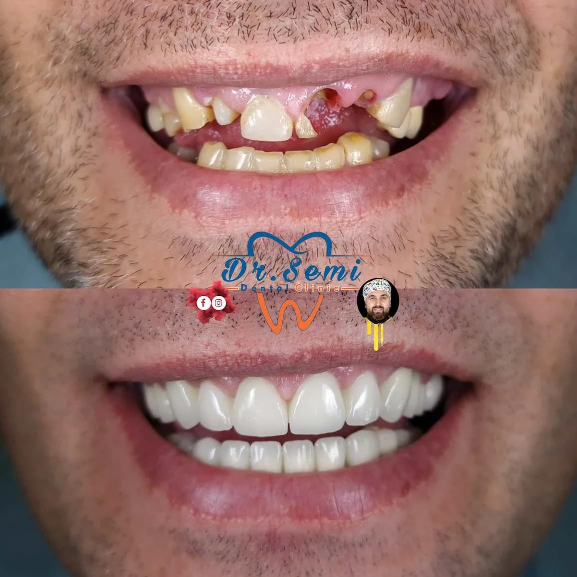 Dental treatment photo 20