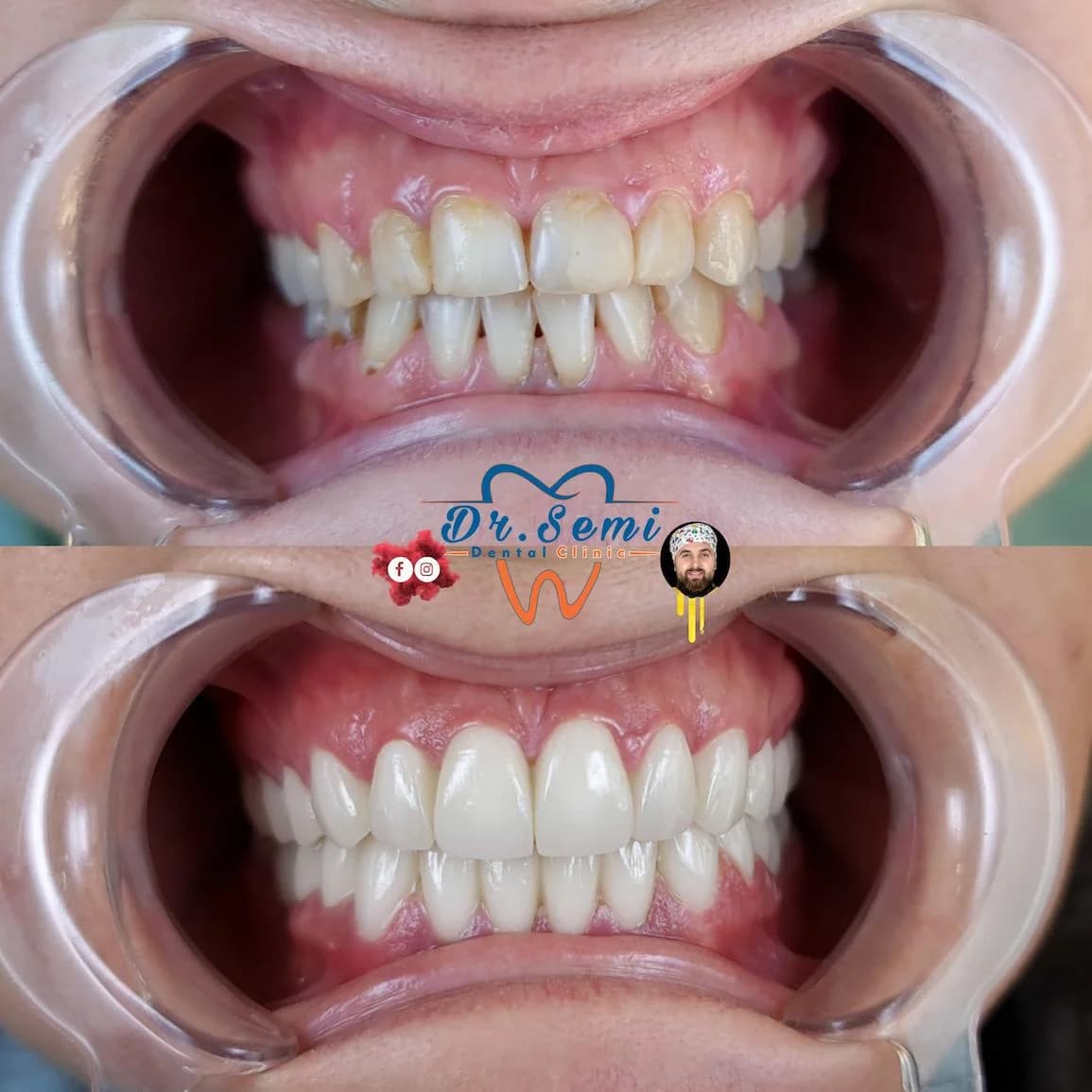 Dental treatment photo 21