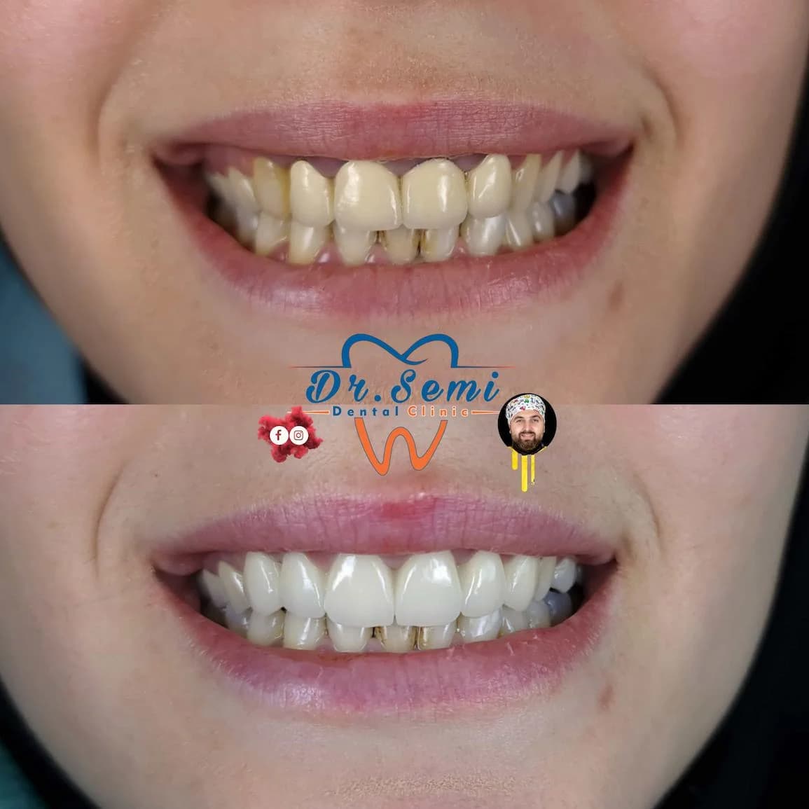 Dental treatment photo 22