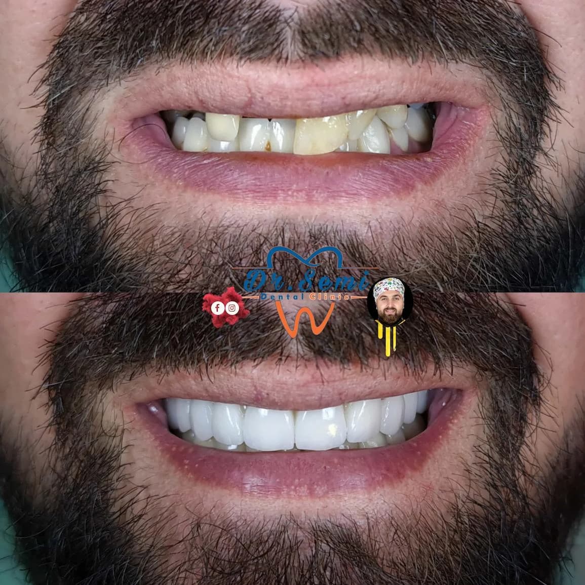 Dental treatment photo 23