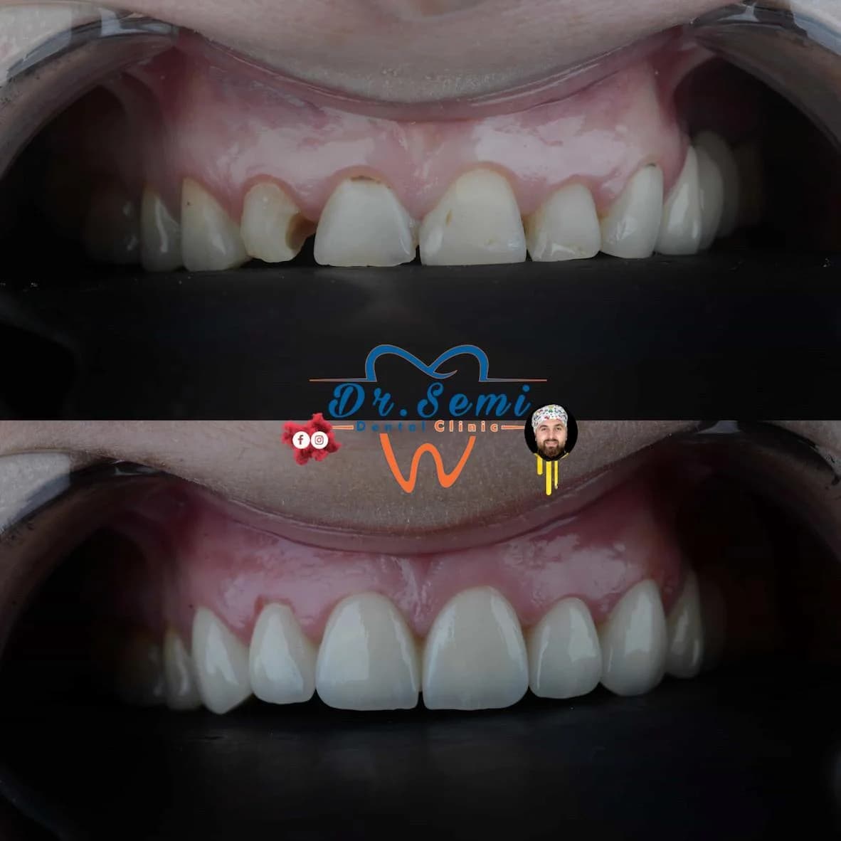 Dental treatment photo 24