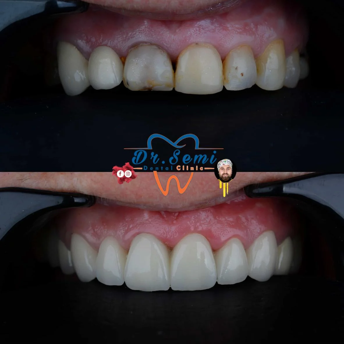 Dental treatment photo 25