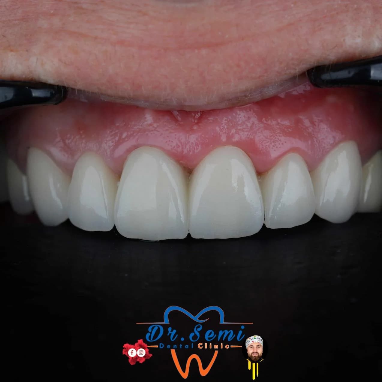 Dental treatment photo 26