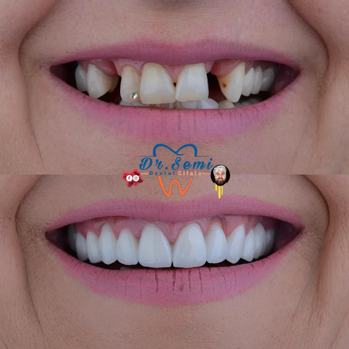 Dental treatment photo 27