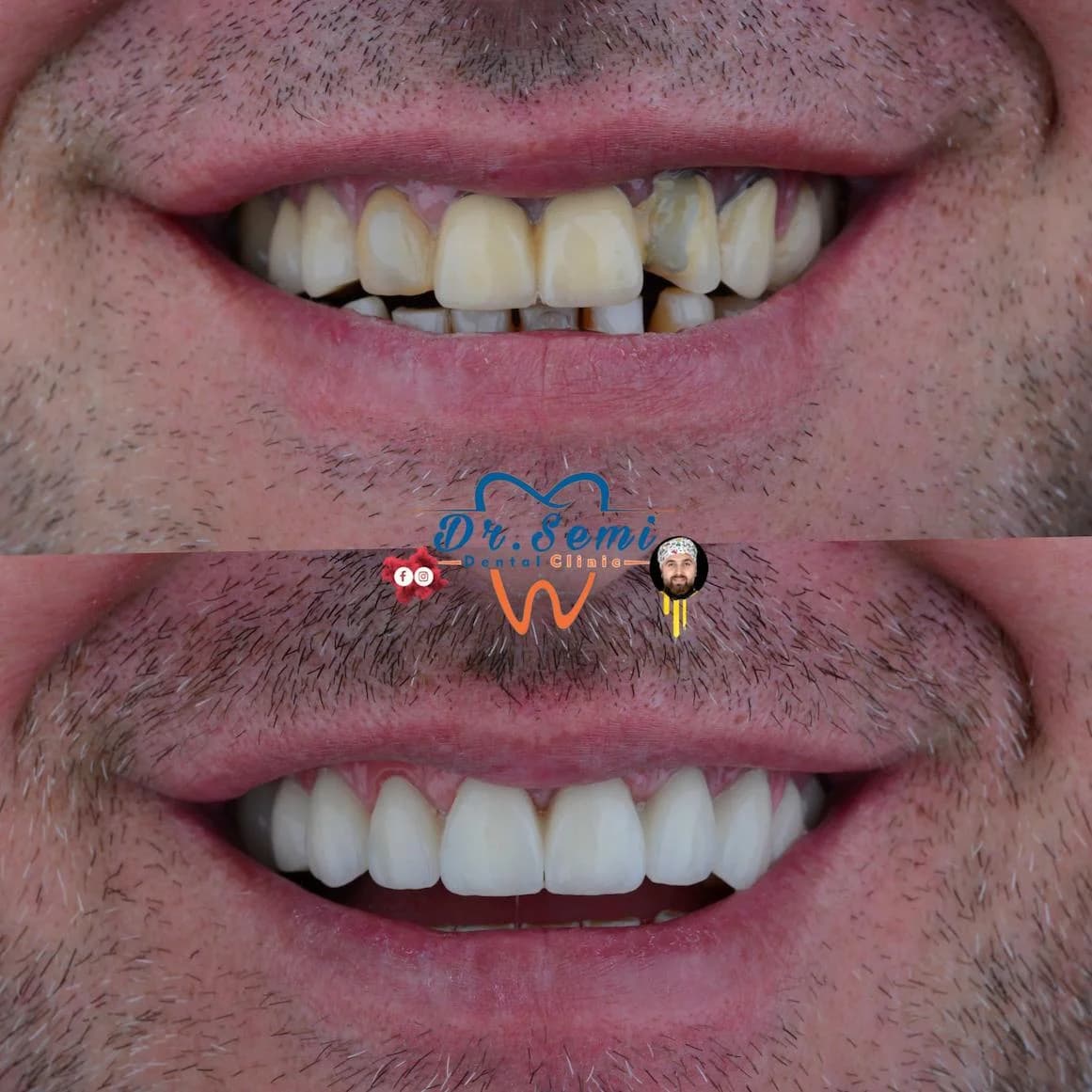 Dental treatment photo 28