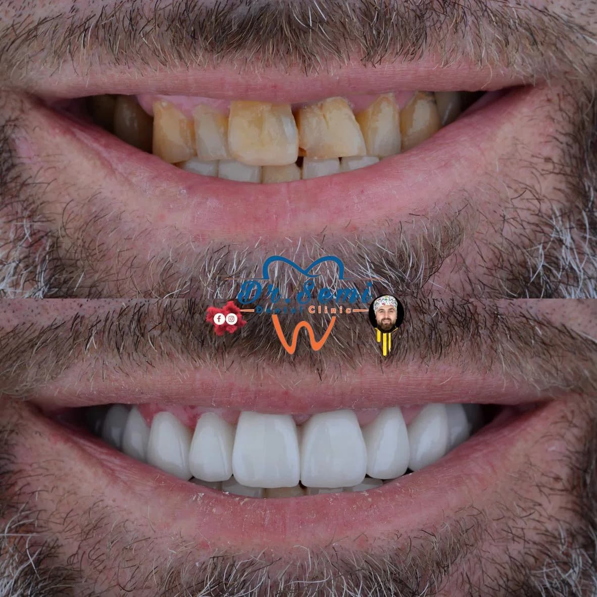 Dental treatment photo 29