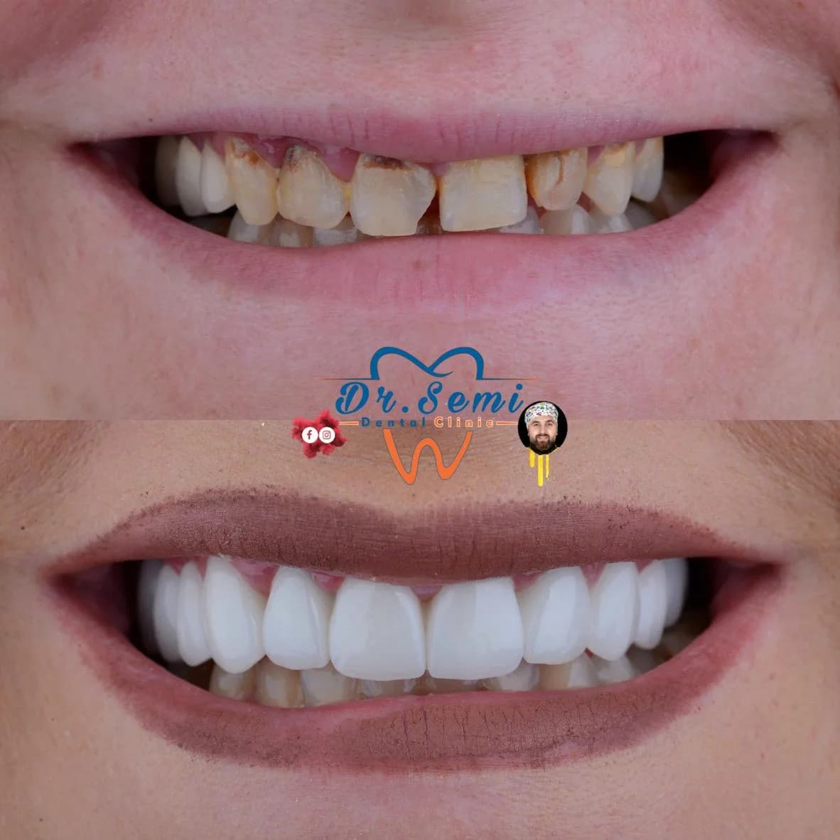 Dental treatment photo 30