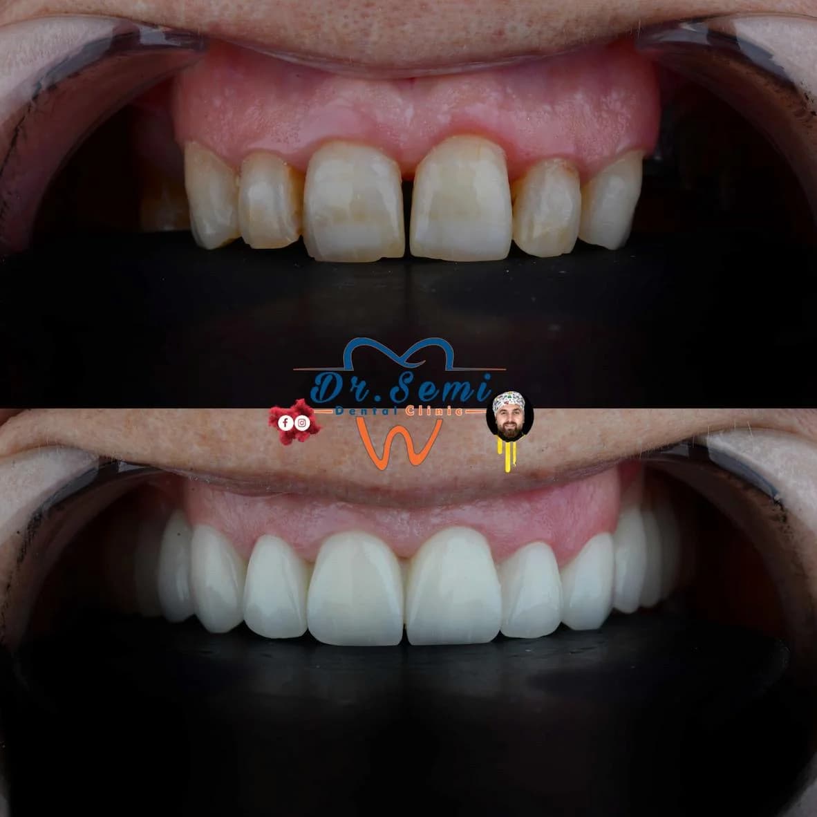 Dental treatment photo 31