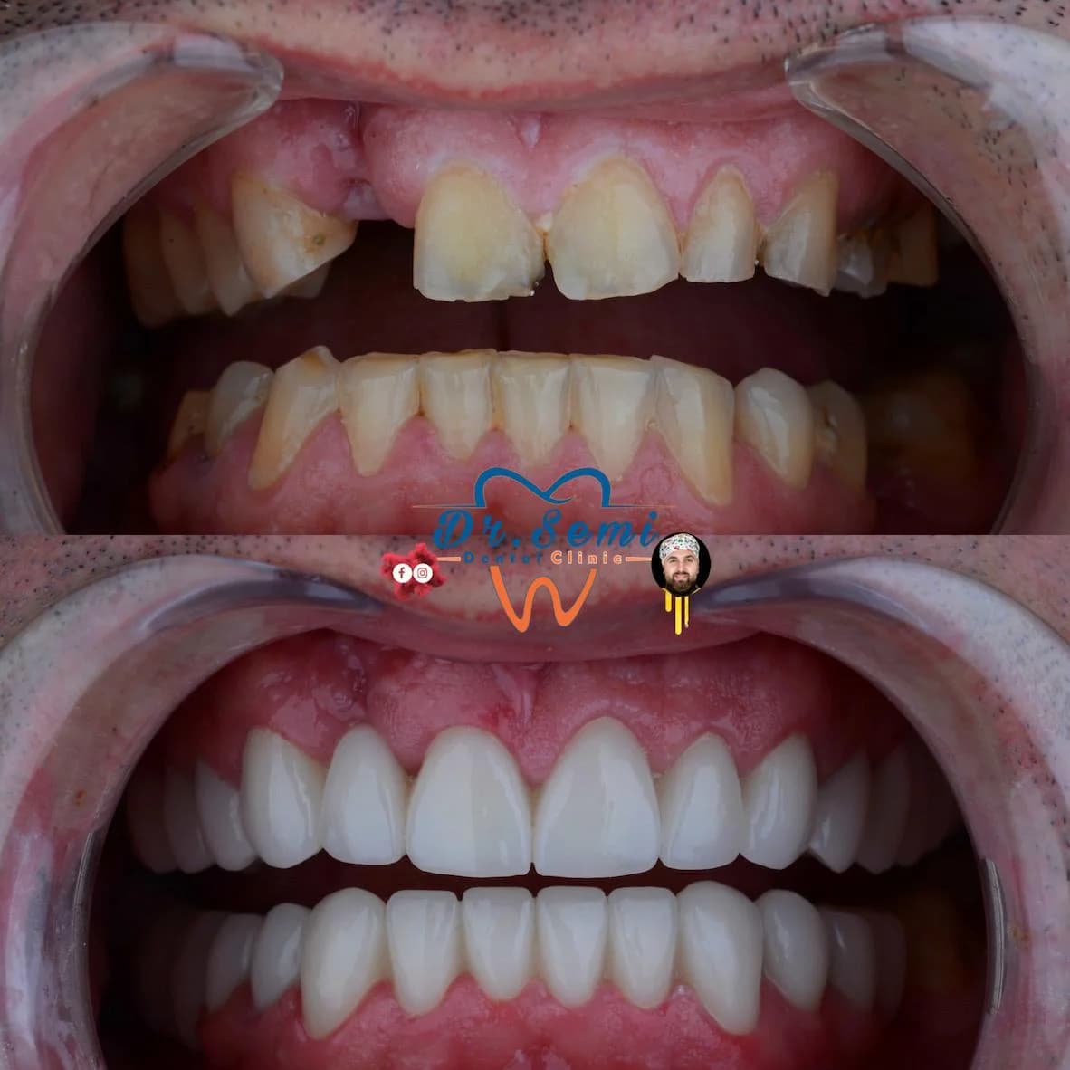 Dental treatment photo 32
