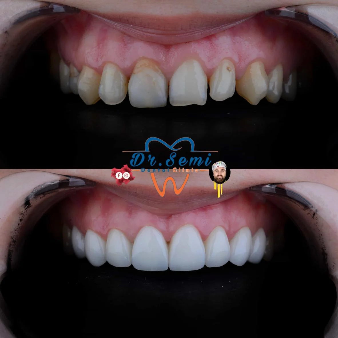 Dental treatment photo 33